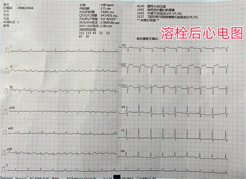 心電圖2_副本.jpg